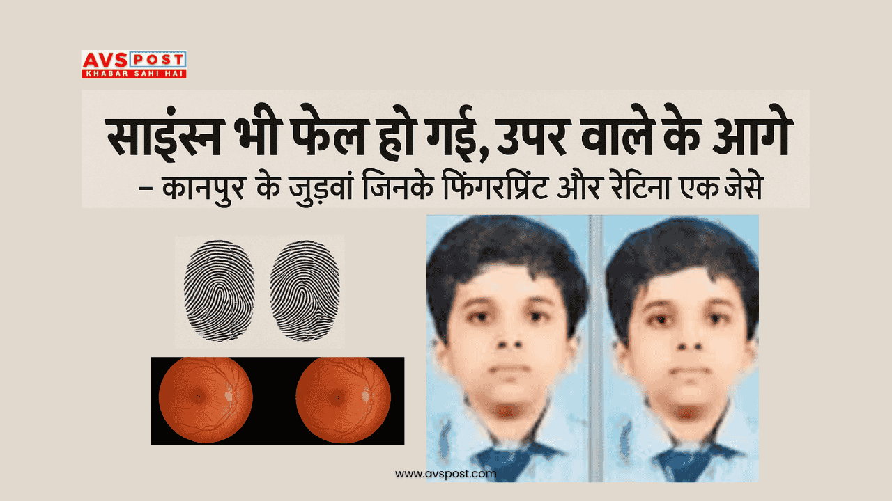 Science fail हो गई, ऊपर वाले के आगे : एक जैसे फिंगरप्रिंट-रेटिना वाले कानपुर के जुड़वां